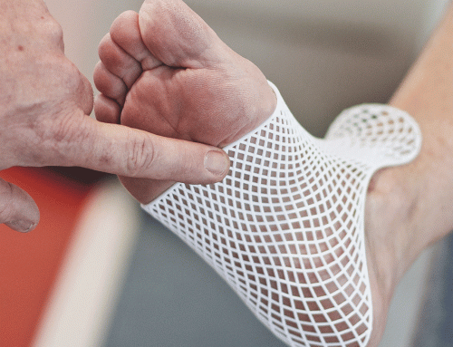 Digital Orthotics / design- and feasibility study, 2017